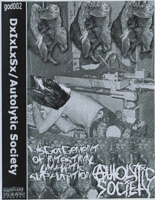 Disgorgement of Intestinal Lymphatic Suppuration - Autolytic Society